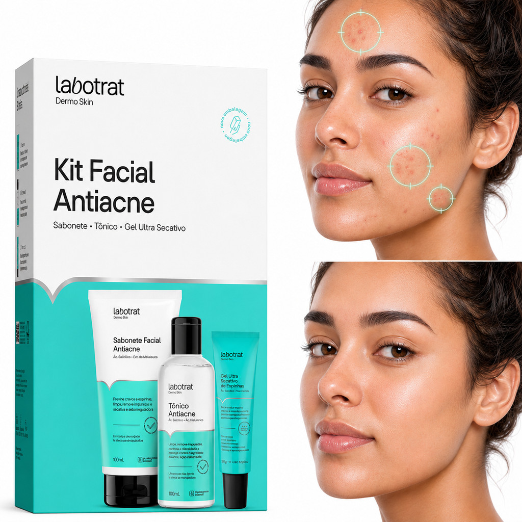 Kit Facial Antiacne Tratamento Intensivo Secativo Cicatrizante Ação Antimarcas sabonete tonico creme gel