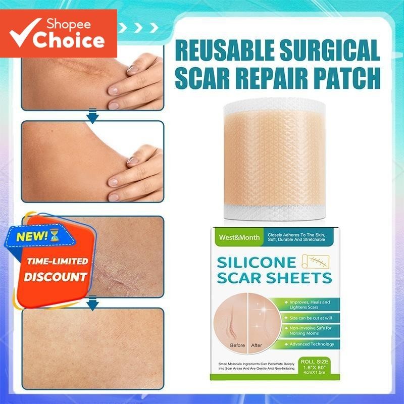 Adesivo De Cicatriz De Silicone West & Mês 4 * 150 Cm Desbota Todos Os Tipos De Cicatrizes Beleza Suave Para Cuidados Co