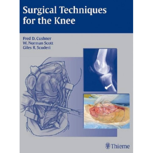 Surgical Techniques for the Knee - Thieme Revinter
