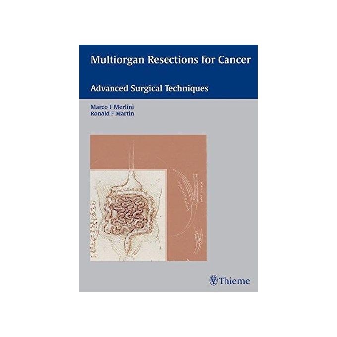 Multiorgan resections for cancer - advanced surgical techniques autor Marco P. Merlini & Ronald F. Martin