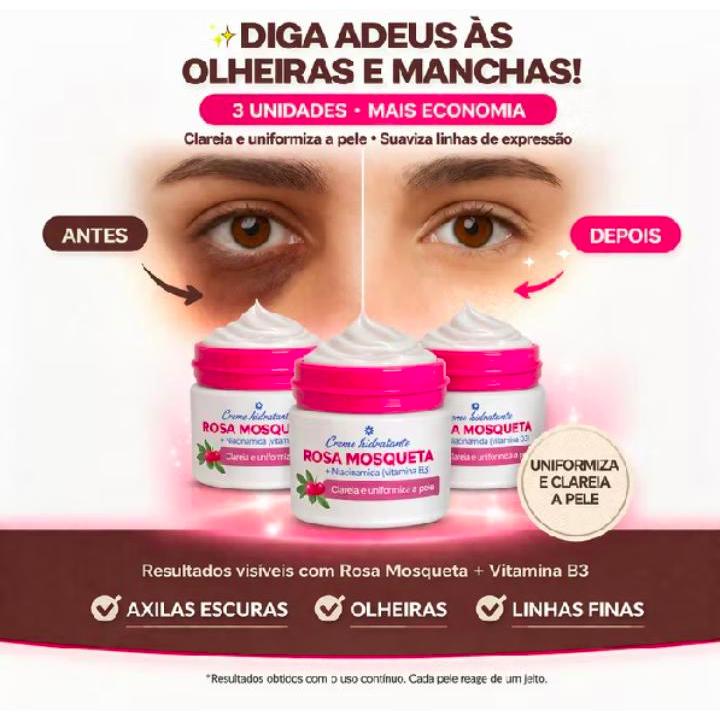🔥 KIT 3 Cremes Rosa Mosqueta + Niacinamida 50g | Clareador, Antiacne, Hidratante Facial Vegano