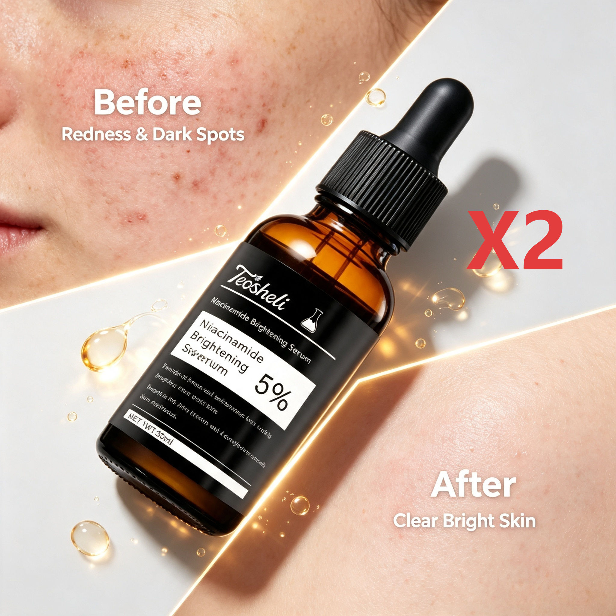 Teashell Clareador de Niacinamida 2 Frascos Cuidados com a Pele Antiacne para Cicatriz de Acne, Redução de Manchas e