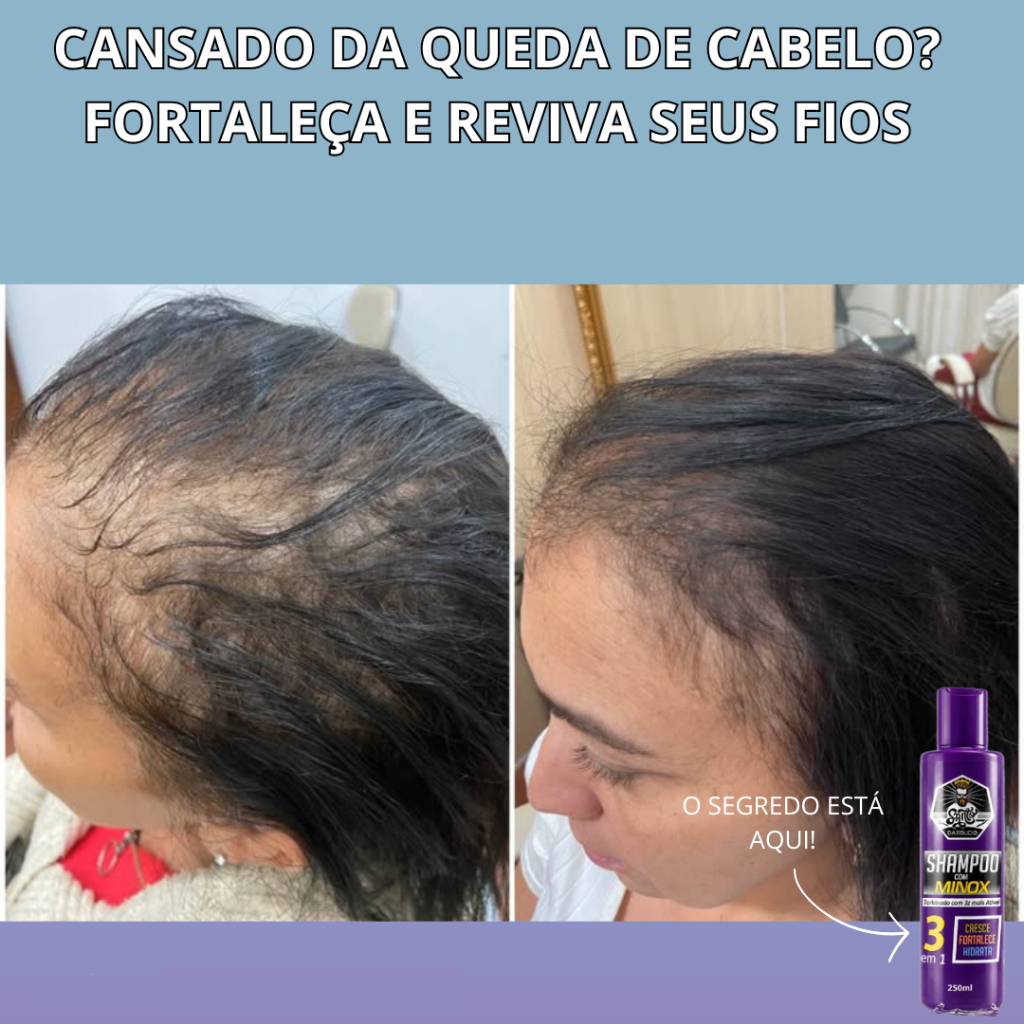 Kit 2 Shampoo Minox Santo Barbudo 3x Mais Forte Reduz Queda, Estimula Crescimento e Hidrata 250ml