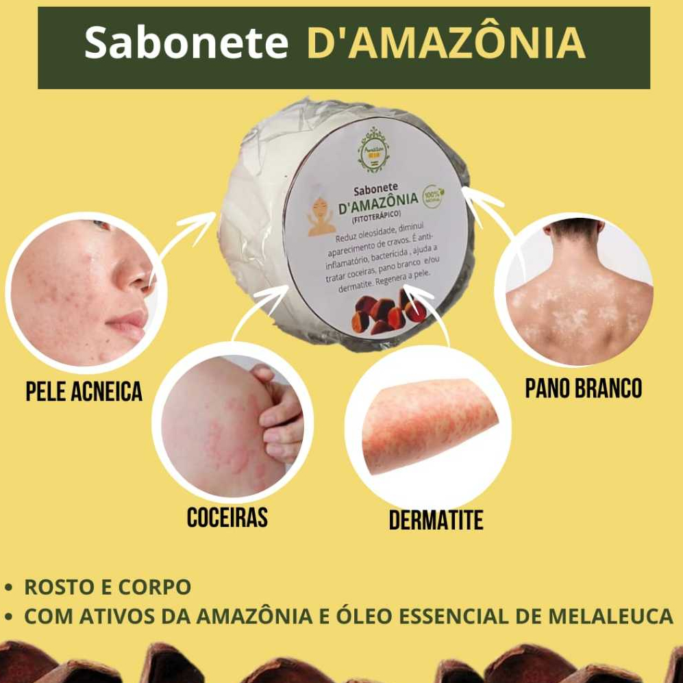 Sabonete fitoterápico  de andiroba- antiinflamatorio, psoríase,cravos, espinhas , pano branco