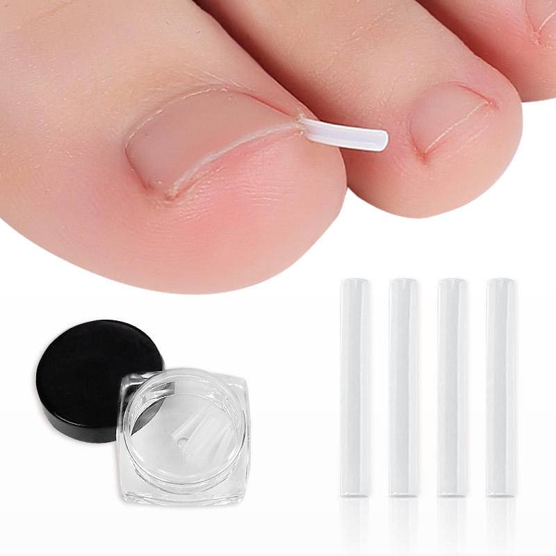 10 Pçs/Set Tiras Corretoras De Unha Encravada , Patches Curvos De Alisamento De Unhas Para Cuidados Com Os Pés