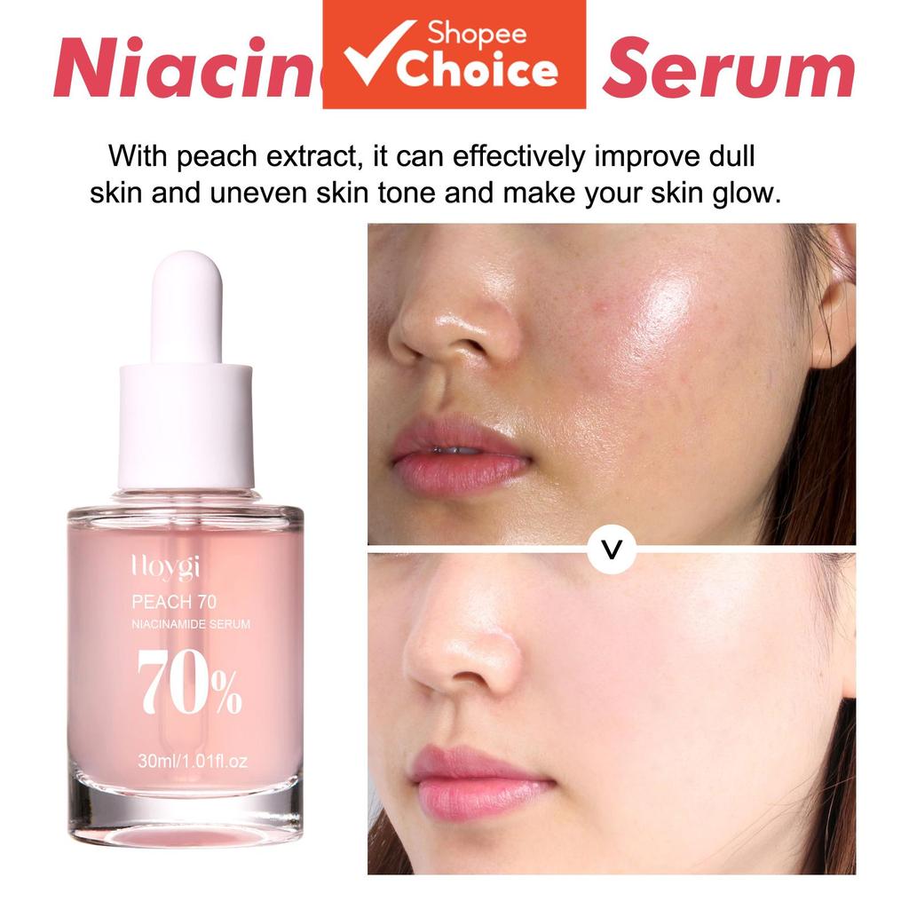 Essência de Pêssego 70% Niacinamida, Aperta e Hidrata os Poros, Reduz Acne, Linhas Finas, Manchas e Deixa a Pele Macia