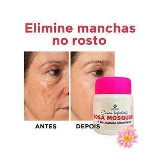 Creme Clareador Rosa Mosqueta com Niacinamida | Manchas no Rosto Antirrugas 50g