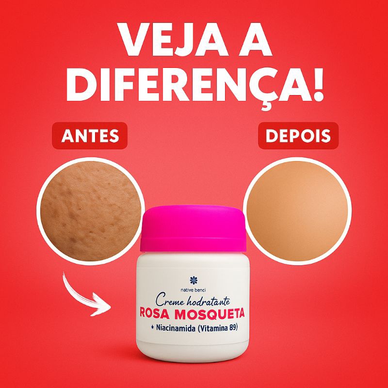 Creme Hidratante Rosa Mosqueta + Niacinamida Vitamina B5 50g | Hidratação Profunda, Clareador de Manchas e Antissinais