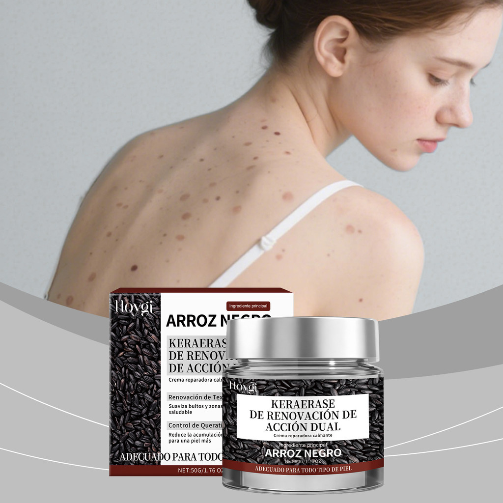Creme Calmante de Arroz Negro 50g com Niacinamida & Óleo de Semente de Chá, Hidratante e Clareador Natural para