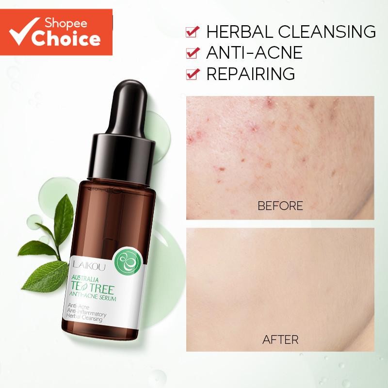 LAIKOU Anti Acne Serum Austrália Tea Tree Essence Controle De Óleo Antiinflamatório 17ml