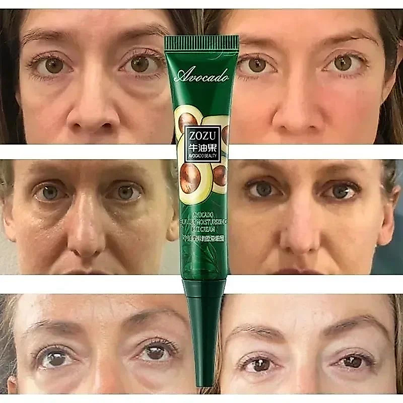 Bolsas Anti-Círculos Escuros Remoção Instantânea De Rugas Creme De Olhos Puffiness Fade Eye Fine Line Apertar Branquear