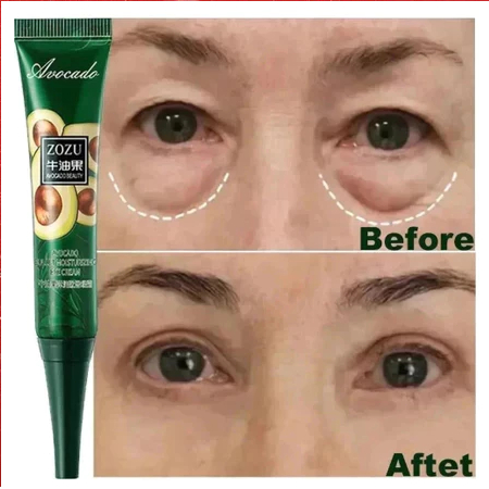 Remoção Instantânea De Rugas Creme De Olhos Anti-Sacos De Círculos Escuros Puffiness Fade Eye Fine Line Apertar Sob Os