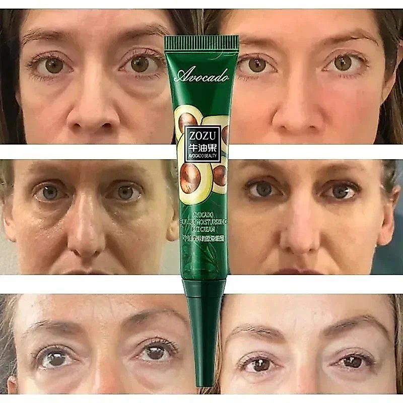 Remoção Instantânea De Rugas Creme De Olhos Anti-Sacos De Círculos Escuros Puffiness Fade Eye Fine Line Apertar Sob Os