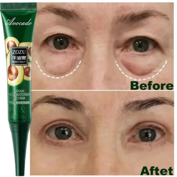 Bolsas Anti-Círculos Escuros Remoção Instantânea De Rugas Creme De Olhos Puffiness Fade Eye Fine Line Apertar Branquear Sob Os Cuidados Com A Pele