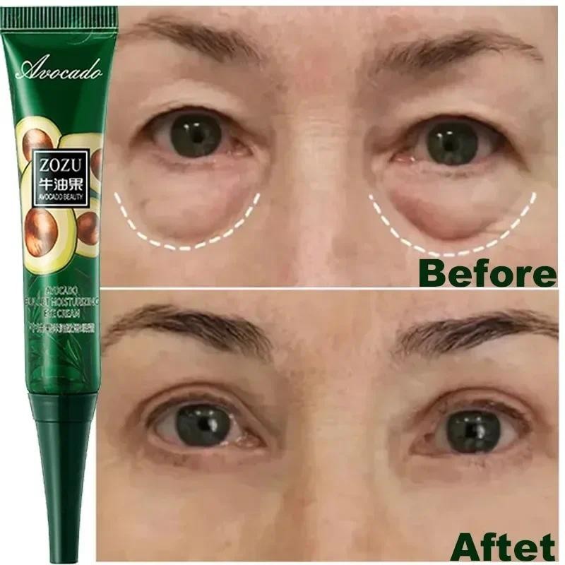 Remoção Instantânea De Rugas Creme De Olhos Anti-Bolsas Círculos Escuros Puffiness Fade Eye Fine Line Apertar Branquear