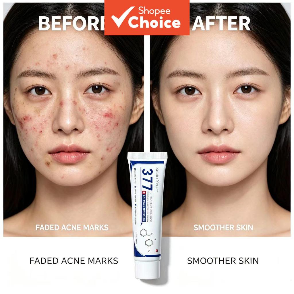 Creme Clareador de Manchas 377 Tretinoína - Ilumina, Uniformiza e Reduz Manchas & Cicatrizes de Acne - Para Pele Opaca e