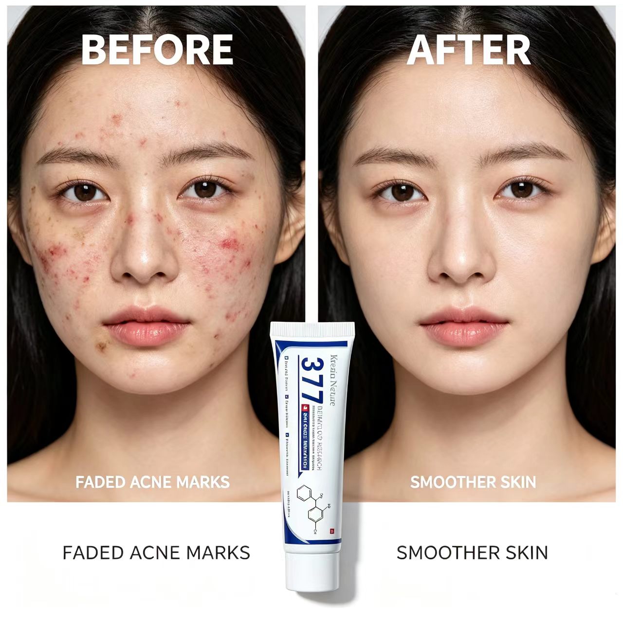 Creme Essence Clareador 377 Tretinoína Clareadora de Manchas Clareamento e Redução de Manchas & Cicatrizes de Acne Para