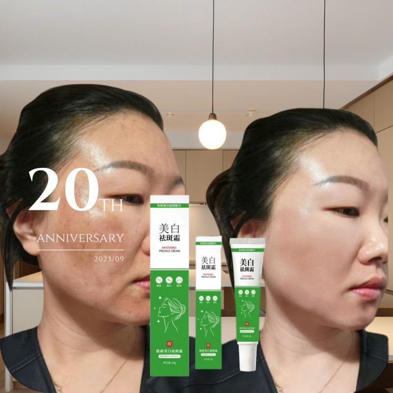 Produto doméstico creme de remoção de sardas melanina sardas cloasma manchas envelhecidas queimaduras solares brilho hid