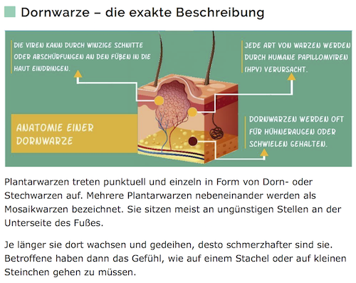 Dornwarze - Der Ratgeber