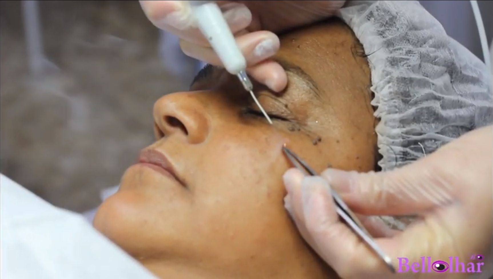 Carreira com Jato de Plasma