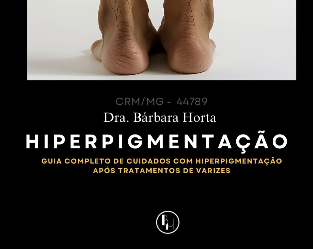 HIPERPGMENTAÇÃO