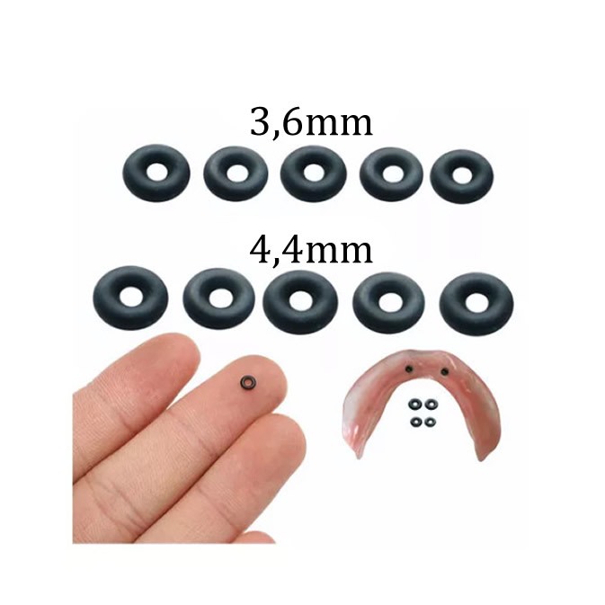 Kit 10 Attachment Borrachinha O-ring Overdenture 3,6mm 4,4mm