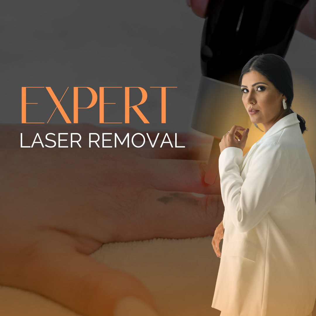 Laser Removal