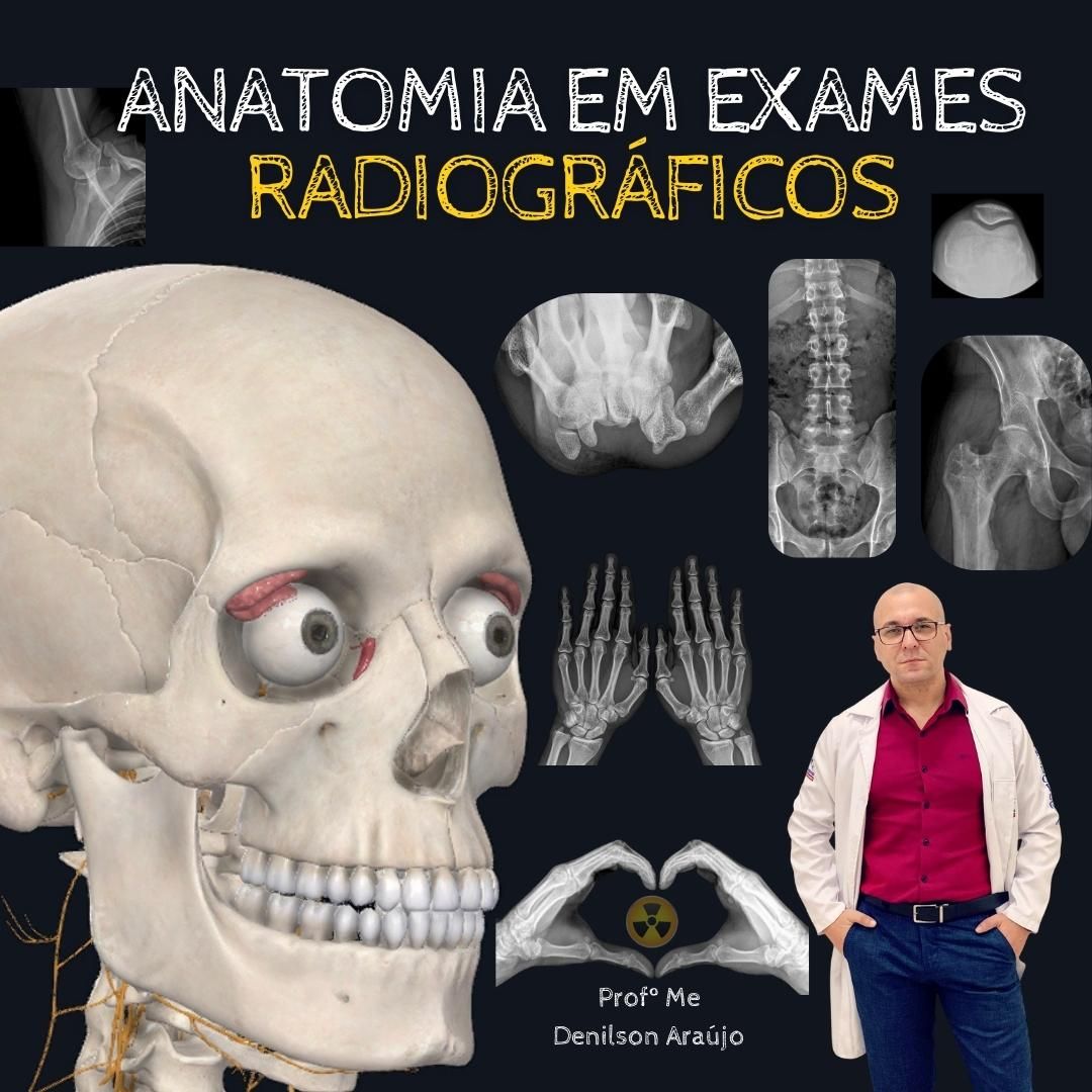 ANATOMIA EM EXAMES RADIOGRÁFICOS