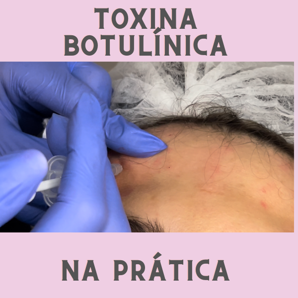 Curso Toxina Botulínica na Prática