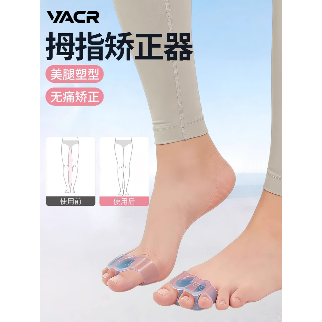 Alemanha-VACR/Thumb Valgus Corrector Toe Splitter Grande Feminino Toe Foot Correção Pode Usar Sapatos Homens Mulheres