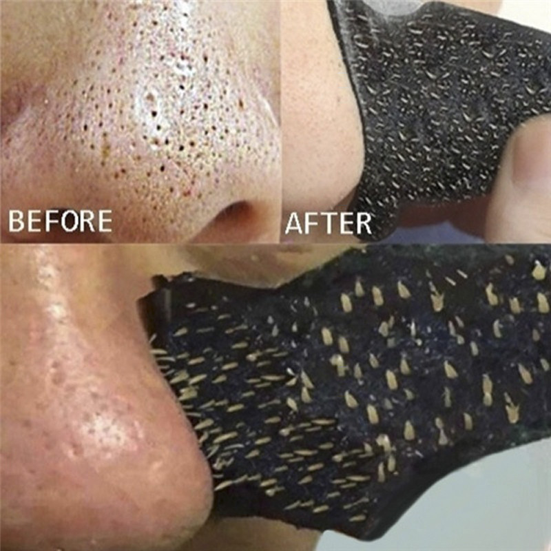 10 adesivos nasais limpos com carvão ativado para remoção de cravos e cuidados com a pele contra acne.