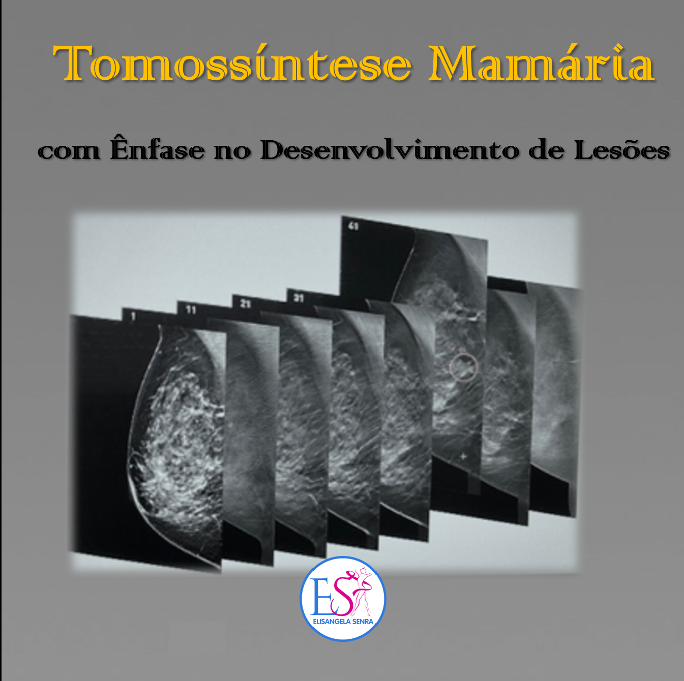 Tomossintese com Ênfase no Desenvolvimento de Lesões