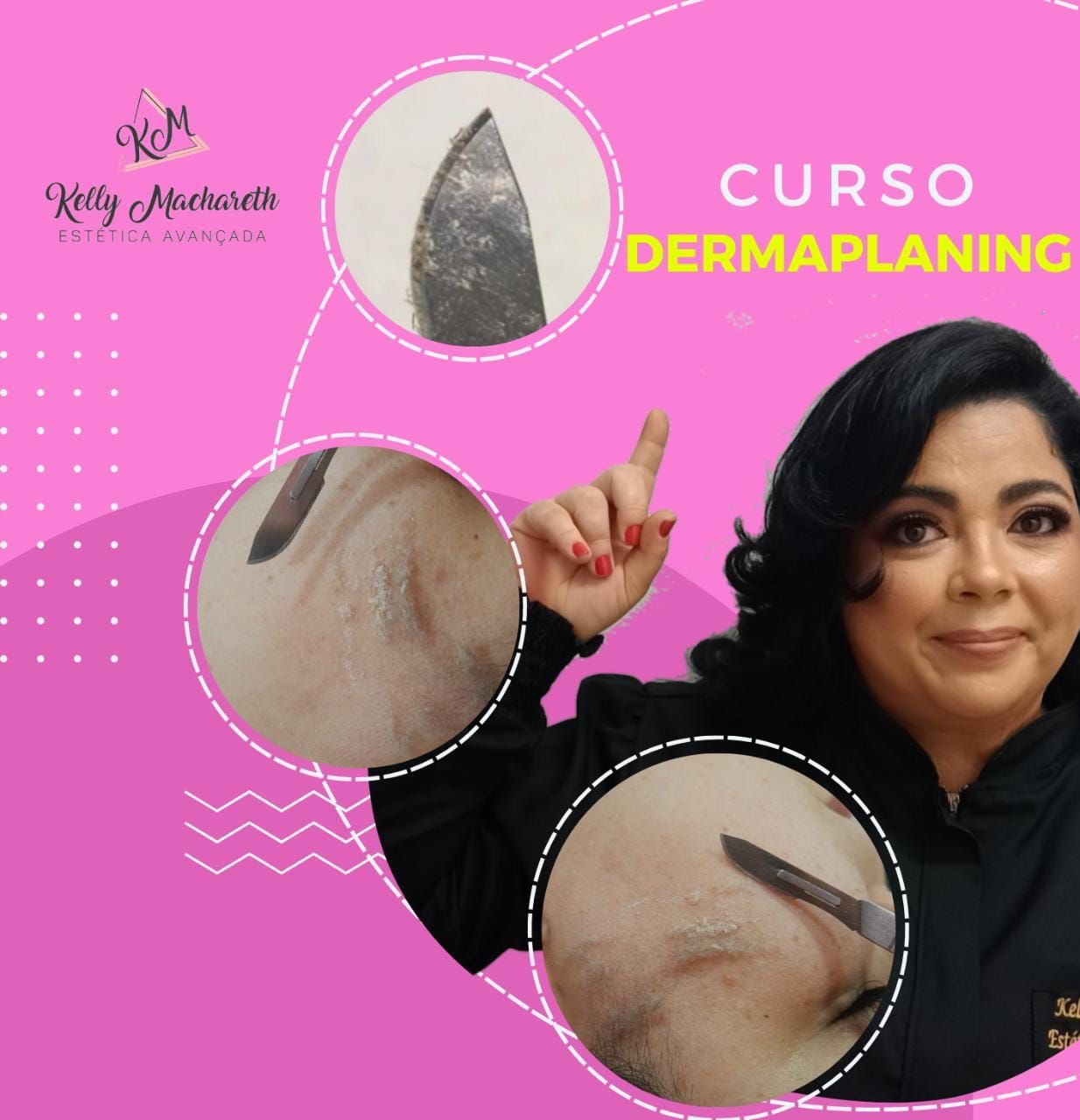 Dermaplaning Perfeito