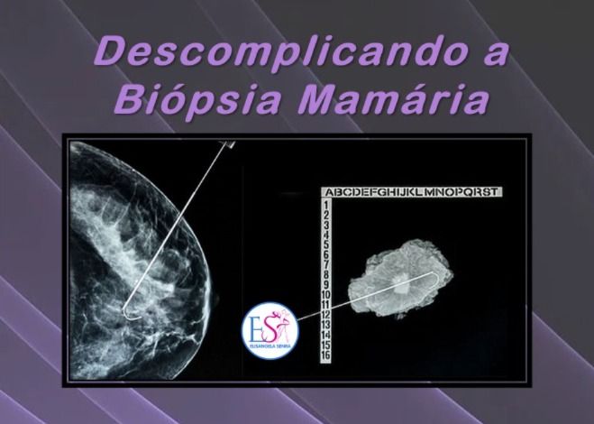 Descomplicando a Biópsia Mamária