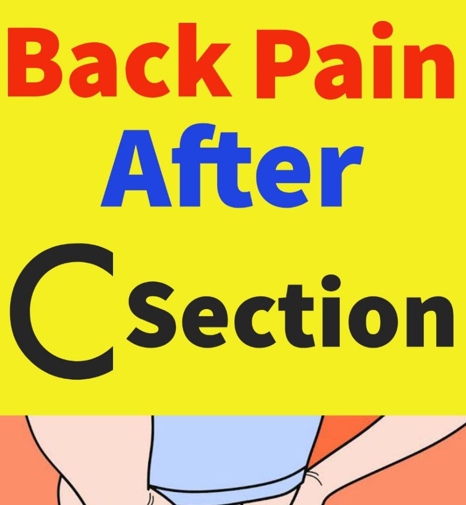 Back Pain after C Section