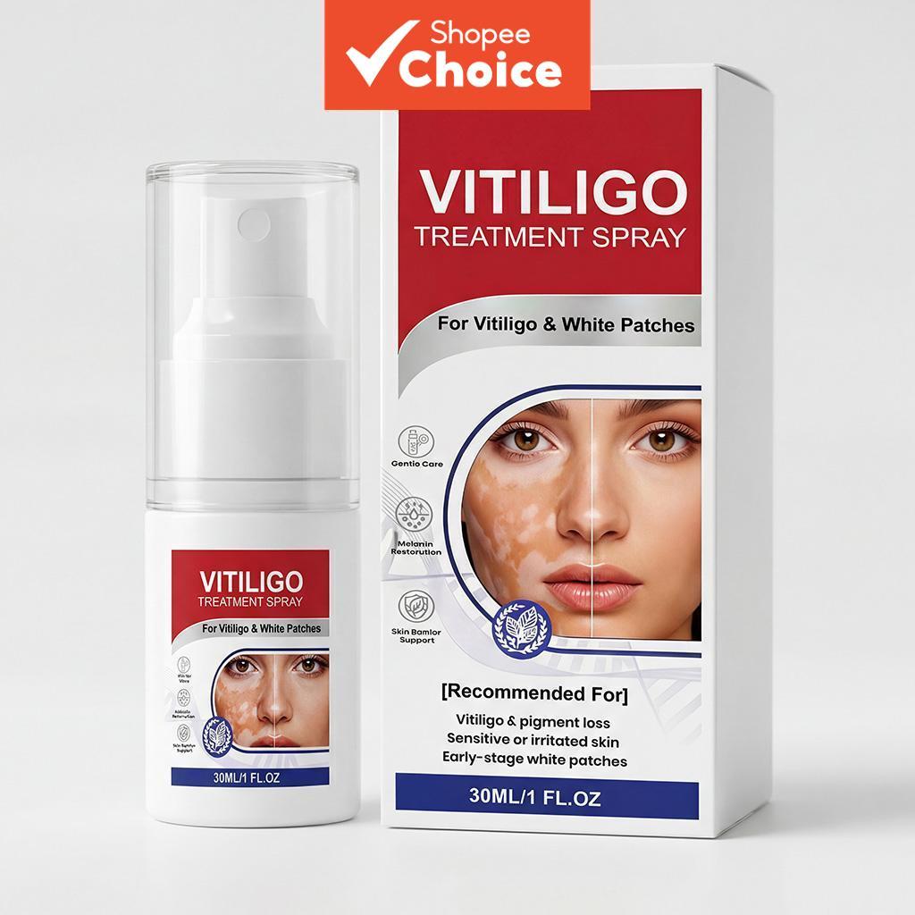 Spray Profissional para Vitiligo & Manchas Brancas 30ml – Carbômero & Arginina para Reforço da Barreira Cutânea |