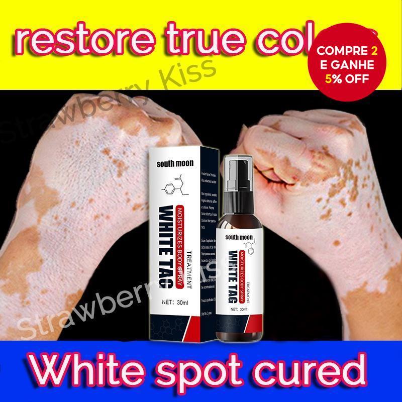[Nemesis de Vitiligo] Creme de Tratamento Removedor de Vitiligo com Óleo de Mostarda Lua do Sul 30ML