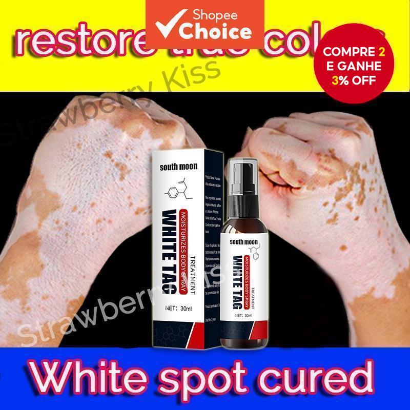 [Vitiligo Nemesis] Óleo de Mostarda do Sul para Tratamento de Remoção de Vitiligo, Creme 30ML