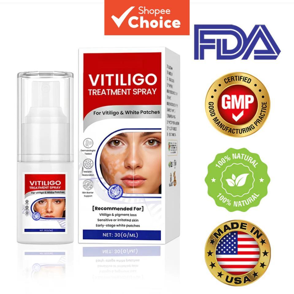 Vitiligo Aparência do Tom de Pele Spray 30ml – Suporte de Pigmento & Reparo da Barreira | Carbômero, Arginina, Cuidado