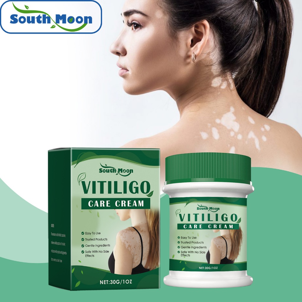 Em Estoque E 30g Vitiligo Leucoplasia Creme De Tratamento Elimina Micose Cura Corretor De Pigmentação Pomada De Reparaçã