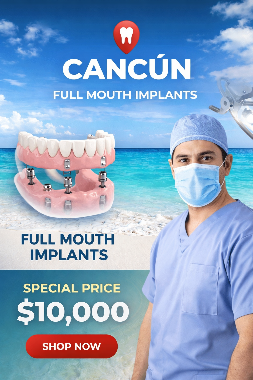 Full Mouth Implants (All-on-4) – Limited Time Offer