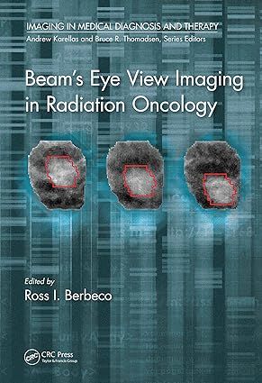 Beam’s Eye View Imaging in Radiation Oncology