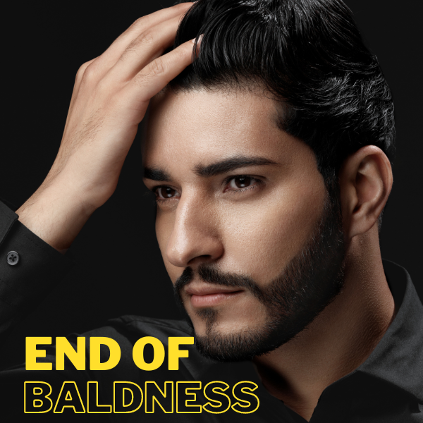 END OF BALDNESS