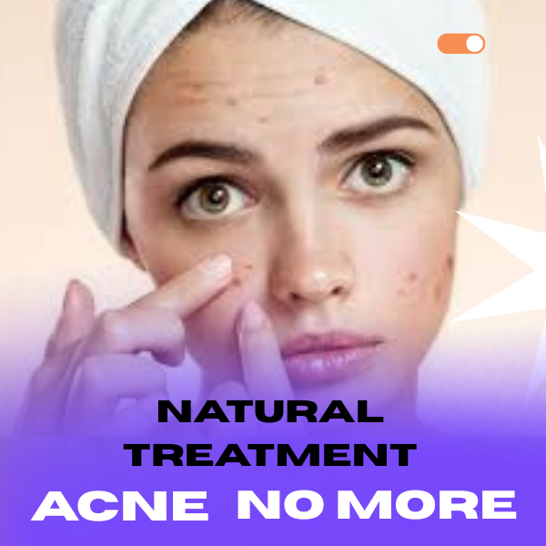 A natural, homemade guide that eliminates blackheads and pimples in just a few days.