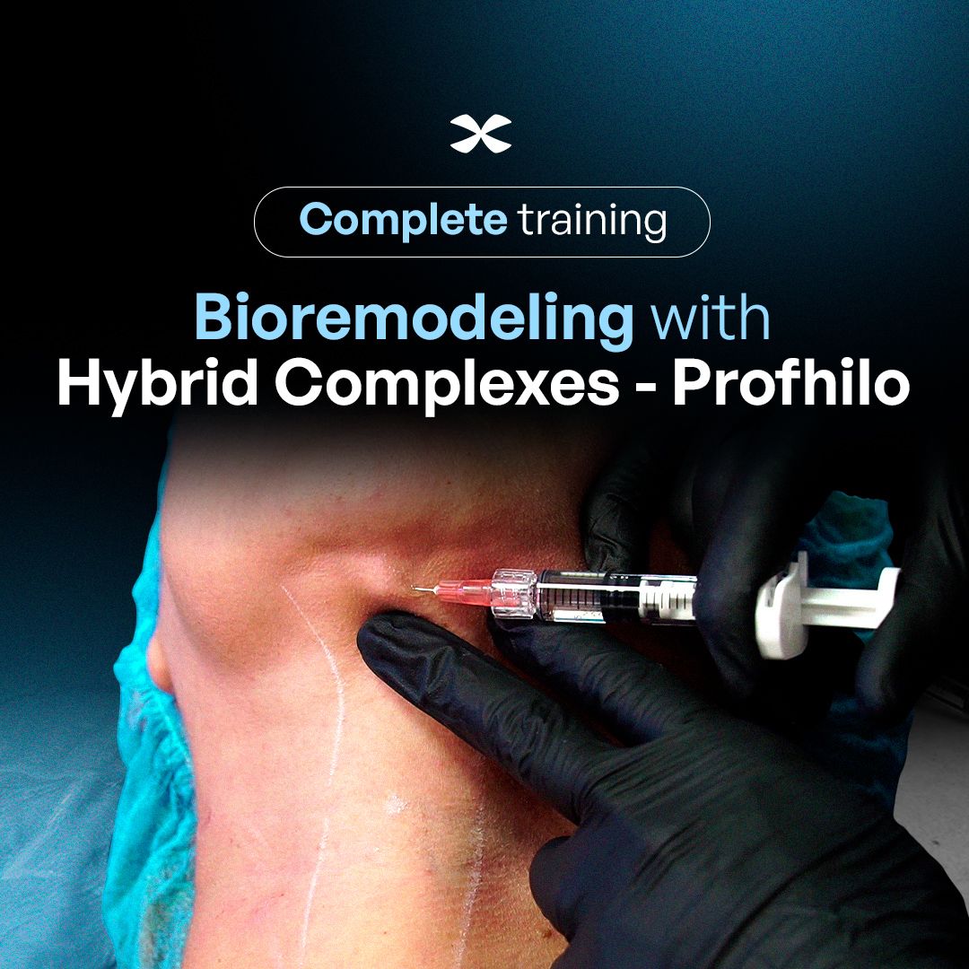 Bioremodeling with Hybrid Complexes of Hyaluronic Acid (Profhilo)