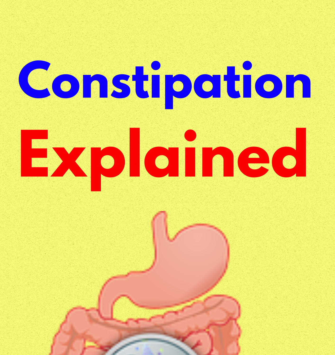 Constipation Explained
