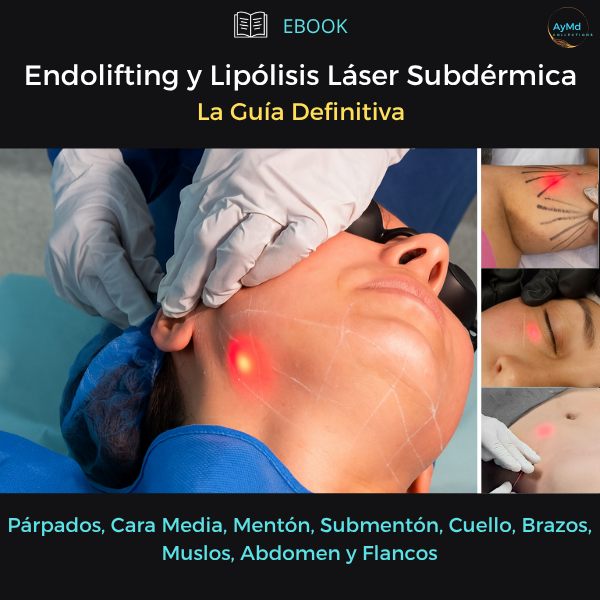 Endolifting y Lipólisis Láser Subdérmica - La Guía Definitiva