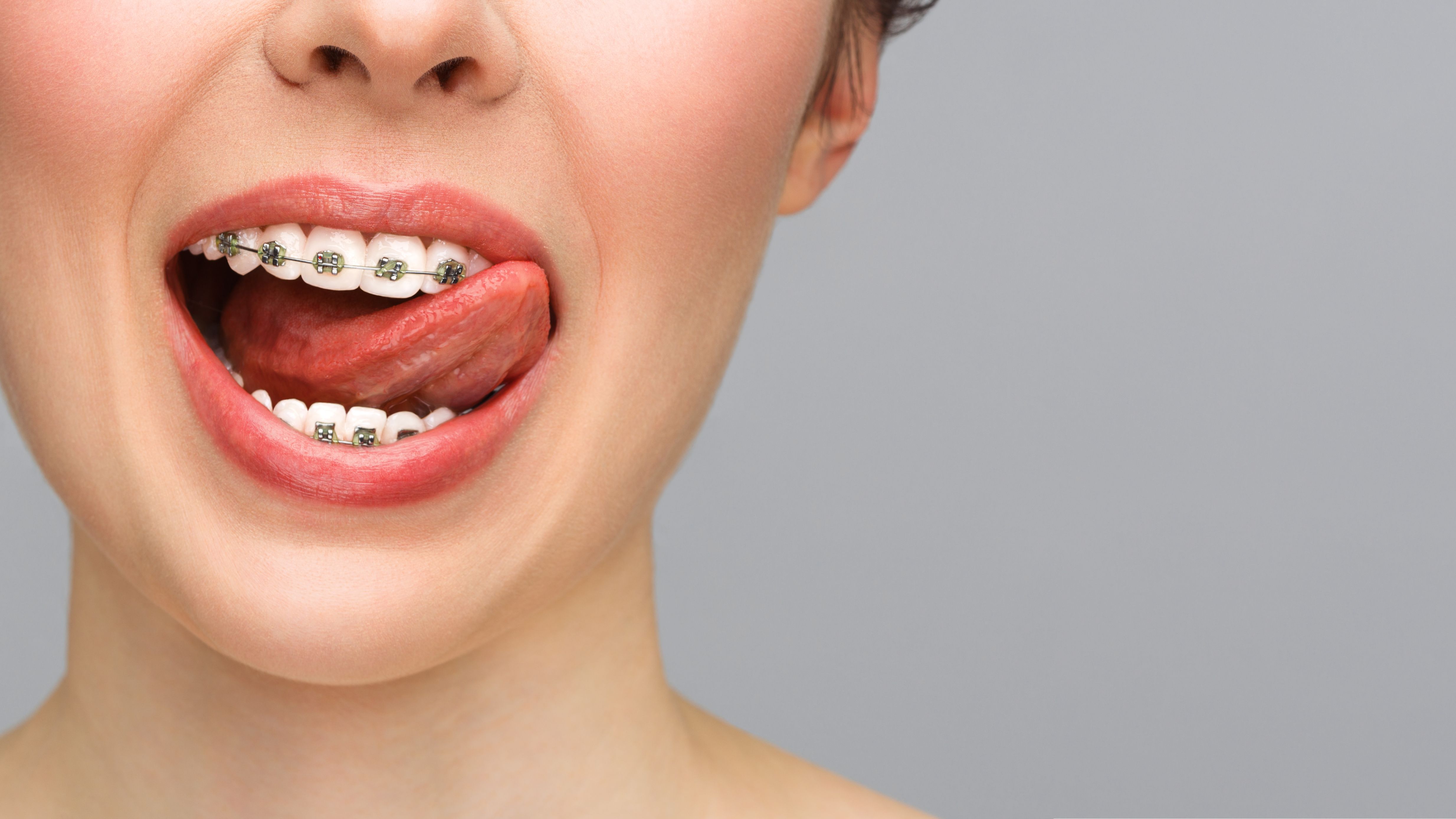 1001 IMAGENES FULL HD PARA ODONTOLOGOS