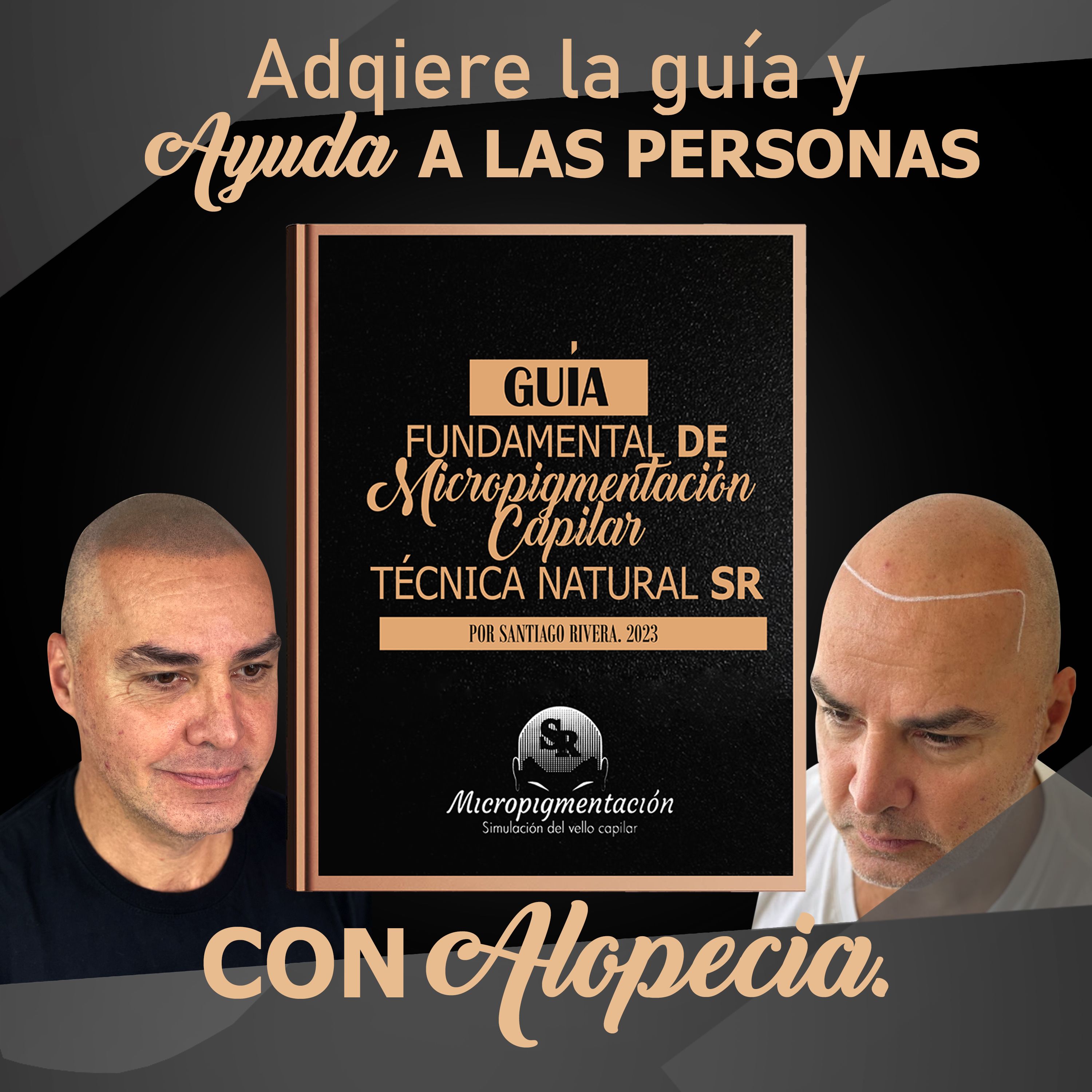 AYUDA A LAS PERSONAS CON ALOPECIA
