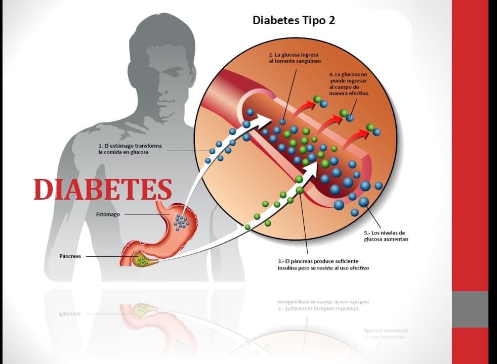FÁRMACOS-PDF (Diabetes tipo 1 y 2 ) Enfermeria-2024